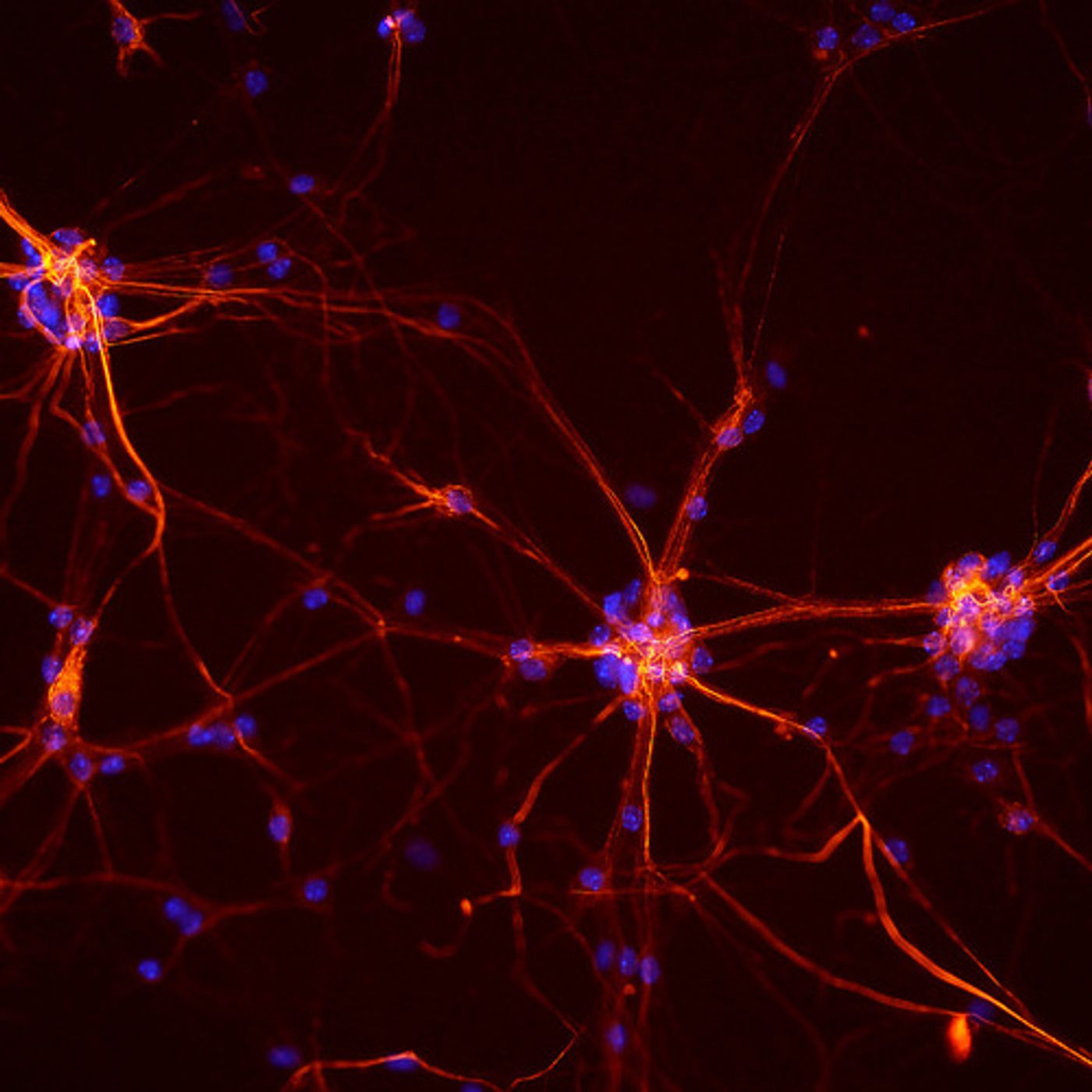 Neurons from a mouse spinal cord. Credit: NICHD/ S. Jeong