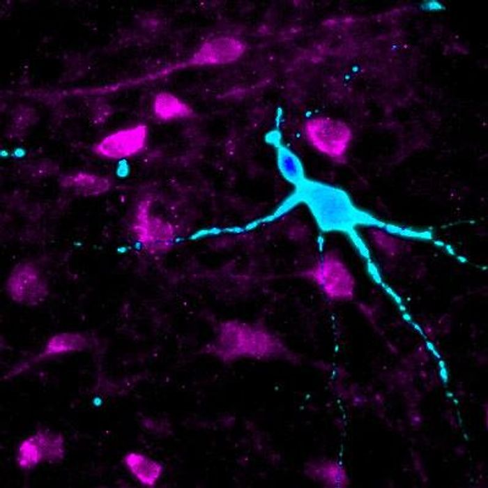 This image shows two types of iPSC-derived hypothalamic neurons: α-melanocyte stimulating hormone (α-MSH) neurons (magenta) and neurophysin II neurons (cyan). α-MSH is involved in appetite control and energy expenditure, while neurophysin II is involved in regulating blood pressure and milk production. / Credit: Uthra Rajamani and Dhruv Sareen at the Cedars-Sinai Board of Governors Regenerative Medicine Institute