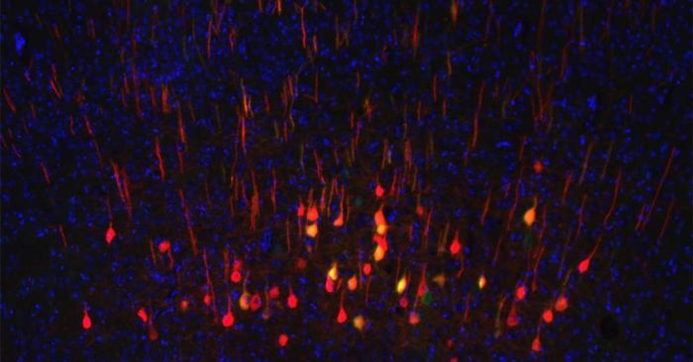 In this photo, courtesy UC San Diego Health Sciences, regenerating neurons (yellow) can be seen along with non-regenerating neurons (red) in a section of mouse brain.