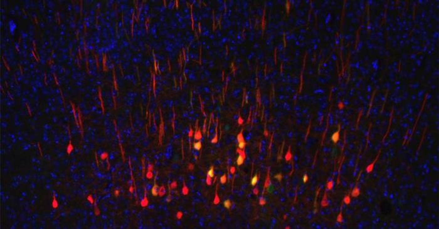 In this photo, courtesy UC San Diego Health Sciences, regenerating neurons (yellow) can be seen along with non-regenerating neurons (red) in a section of mouse brain.