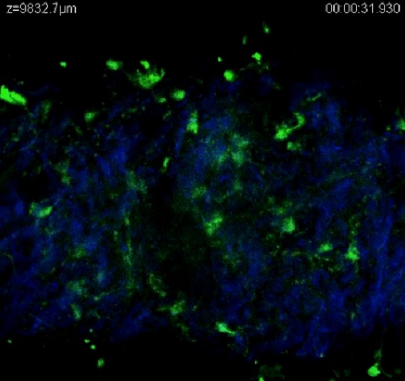 Nitric oxide (green) signaling in various layers of a blood vessel. Credit: PLOS ONE