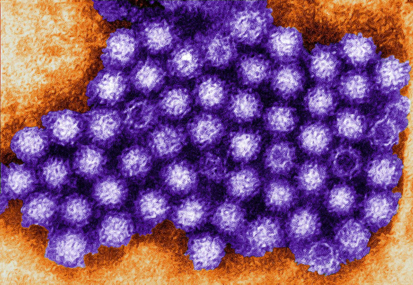 Norovirus / Credit: public-domain-image.com