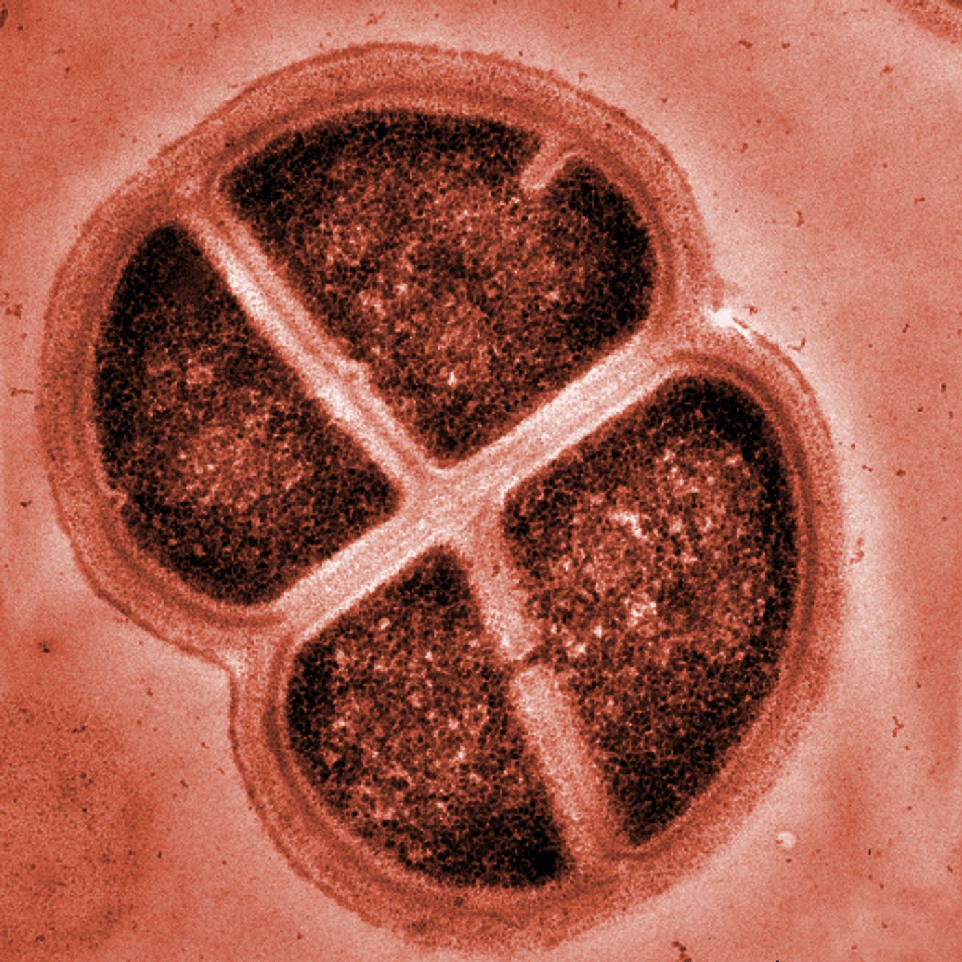 Cells of Deinococcus form tetrads.
