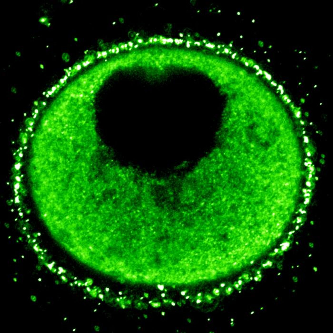 Sea star (Patiria miniata) oocyte with fluorescent Vitellogenin-GFP.  / Credit: D. Nathaniel Clarke