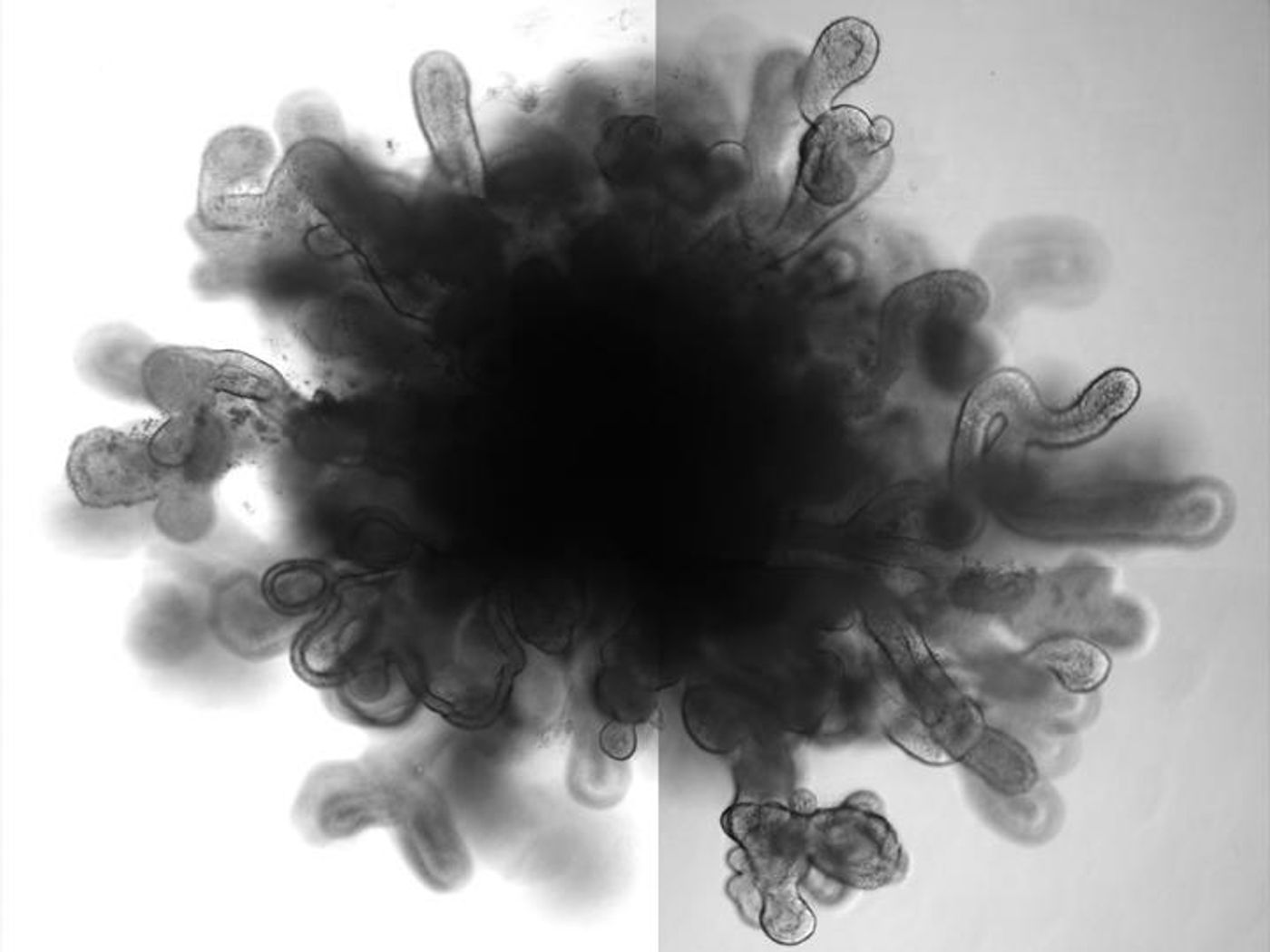 Bright-field images of day 50 LBO-derived Matrigel colonies from RUES2 cells. Representative of six independent experiments. Scale bars, 500?μm. / Credit: Snoeck lab/Columbia University Medical Center