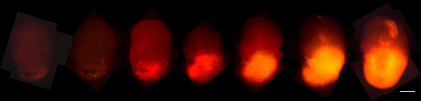 L to R, tumor cells labeled with (red) tdTomato grow in a cerebral organoid 2,3,4,6,8,10,13 weeks after transduction./Credit:Salk Institute