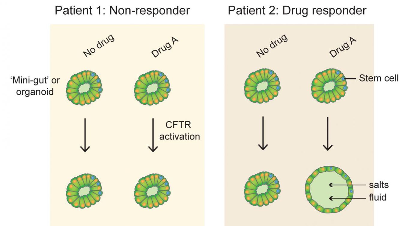 The response to CFTR-targeted drugs measured by swelling of intestinal organoids differs between subjects with cystic fibrosis. This material relates to a paper that appeared in the 22 June 2016, issue of Science Translational Medicine, published by AAAS. Image by Johanna Dekkers/University Medical Center Utrecht