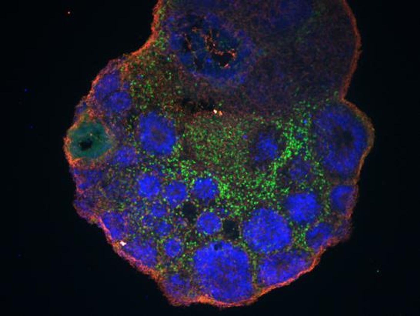 Studying lab-grown cerebral organoids (one derived from chimpanzee cells, shown) has helped scientists discover genes active only in developing human brains. / Credit: Vincent Meng and Andrew Field