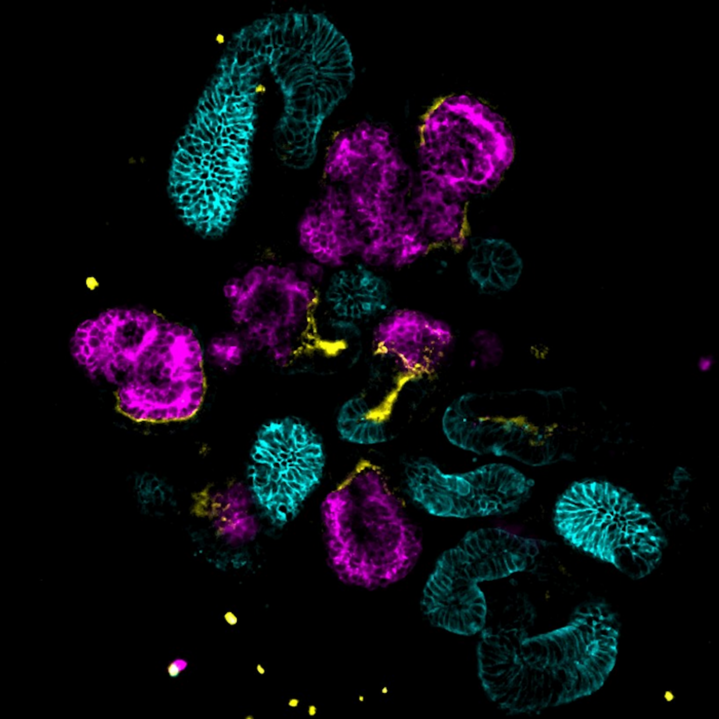Microscope image of kidney organoids used to solve a mystery about TSC / Credit: Cell Research