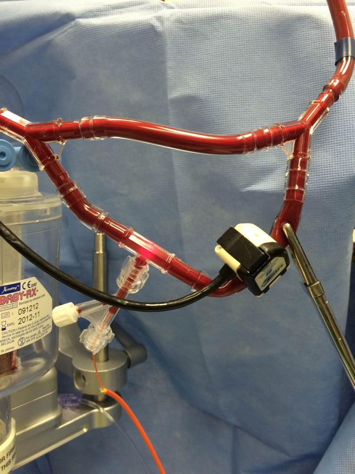 The blood-monitoring device taps directly into the heart-lung machine used to circulate blood during a patient's surgery. Credit: University of Central Florida