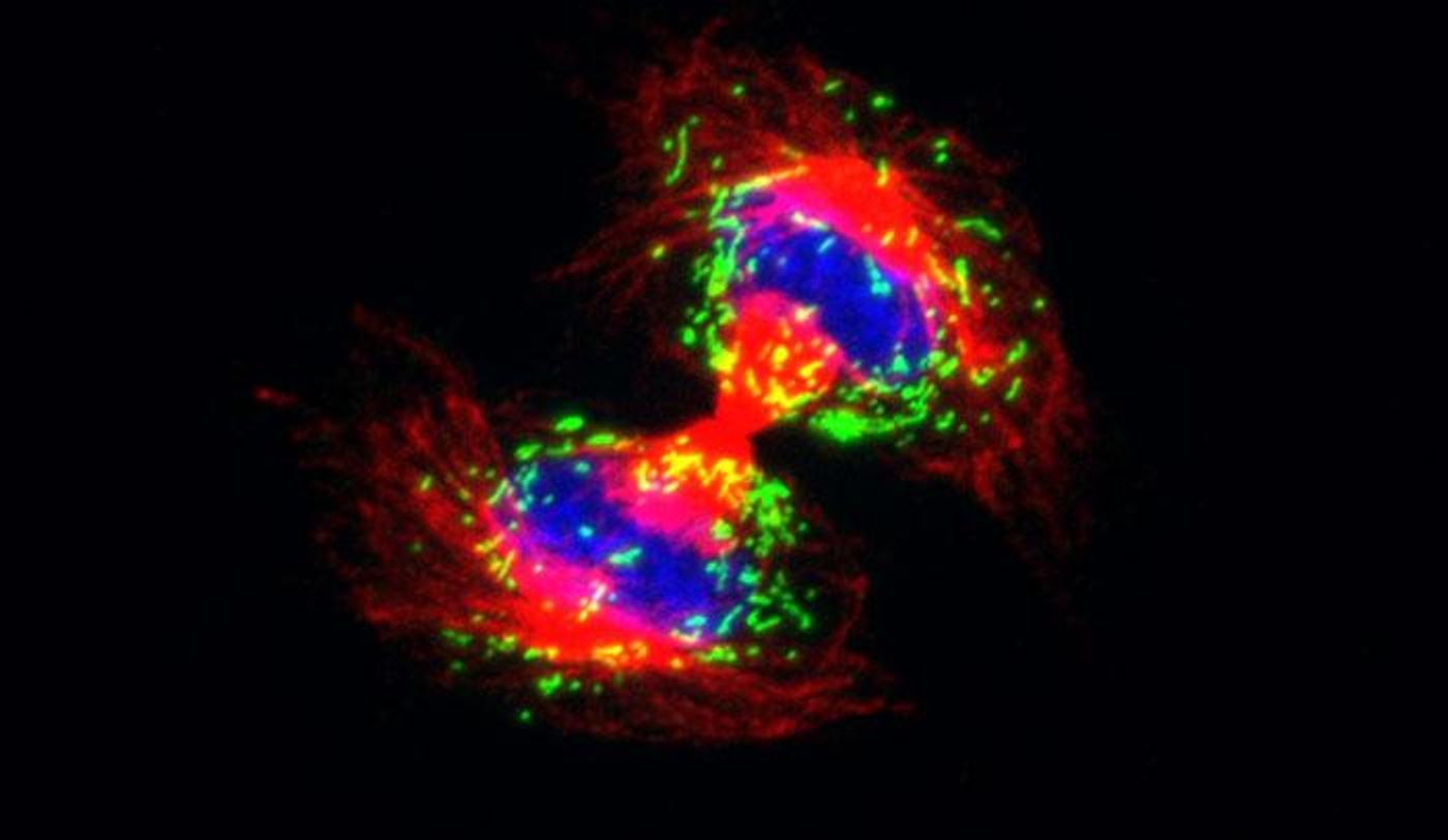 In a dividing cell (above), tiny organs called peroxisomes (green) are evenly distributed in distinctive arcs. In cells lacking the protein Pex11b, peroxisomes are no longer allotted equally. / Credit: Laboratory of Mammalian Cell Biology and Development at The Rockefeller University/Science