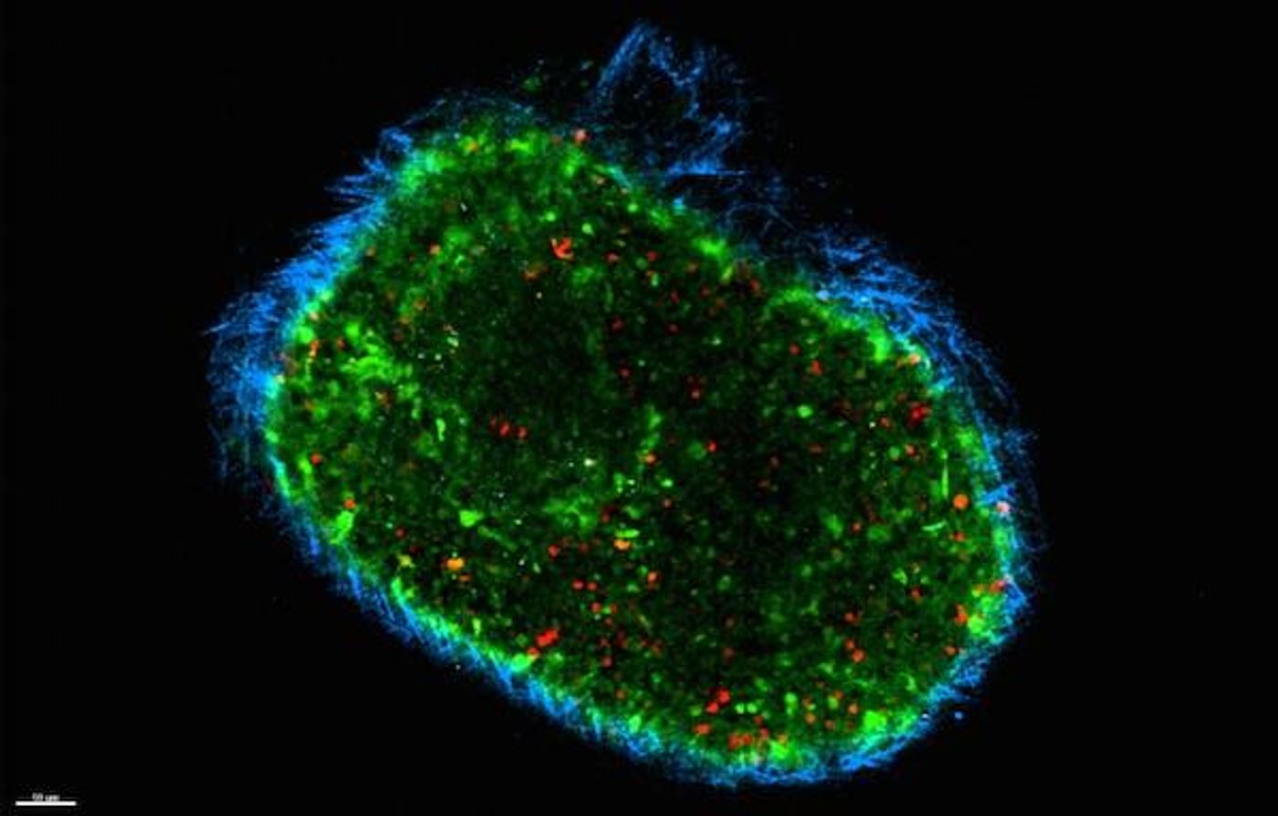 Cells that have exited from a tumor (red) in a lymph node of a photoconvertible mouse model. Credit: Tatyana Chtanova
