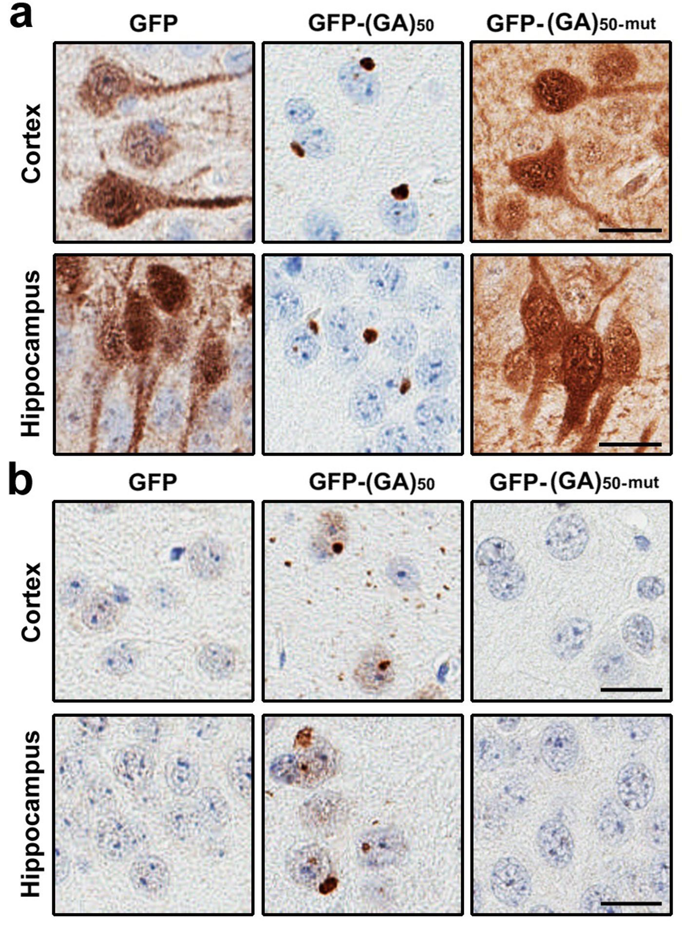 Visible inclusions in neurons from the poly(GA) mice.