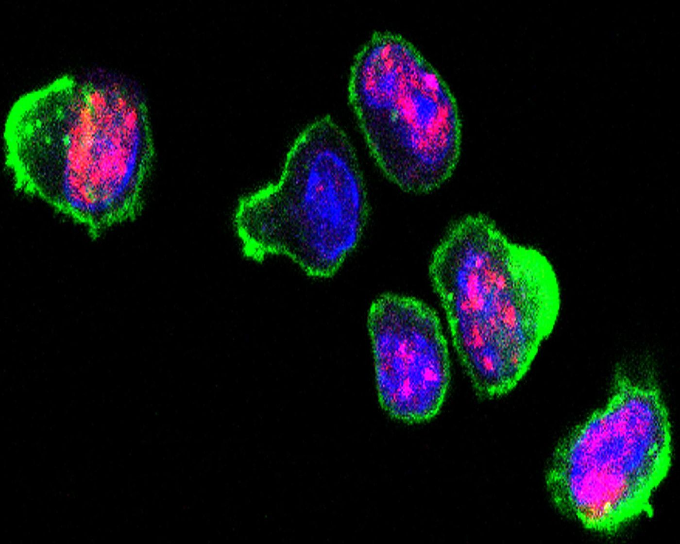 Activated mouse T-cells with markers indicating DNA damage repair signaling (shown in pink). Credit: Cincinnati Children's