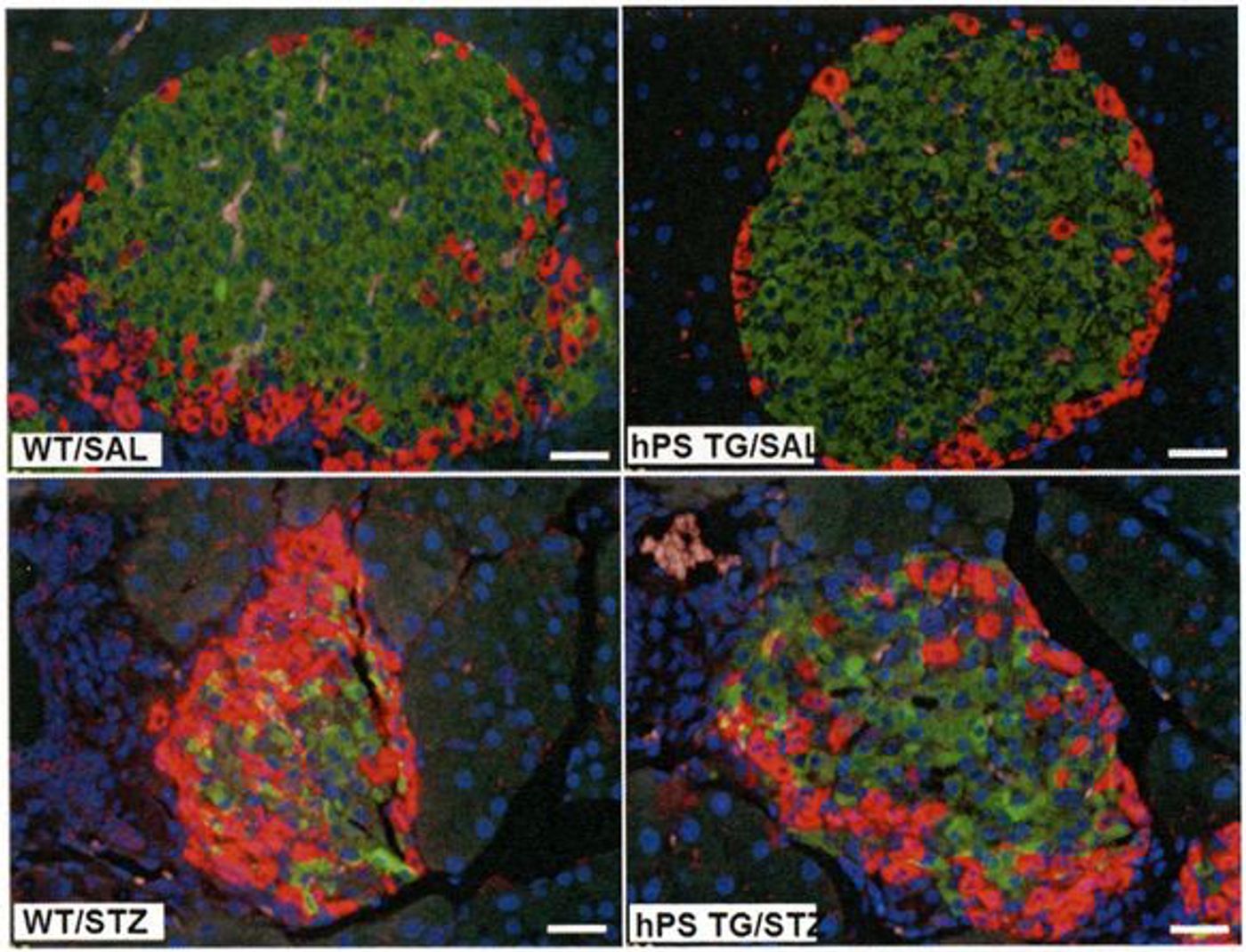 Mice altered genetically to make more protein S (hPS-TG) mice showed less apoptosis of islet ?-cells. As the insulin (green) stained area decreased, the area of glucagon (red) staining was significantly increased in the WT/ Streptozotocin (induces beta cell death) group compared with the WT/Saline Control group but remained unchanged in the hPS TG/ Streptozotocin compared with the saline-treated group / Credit: Diabetes