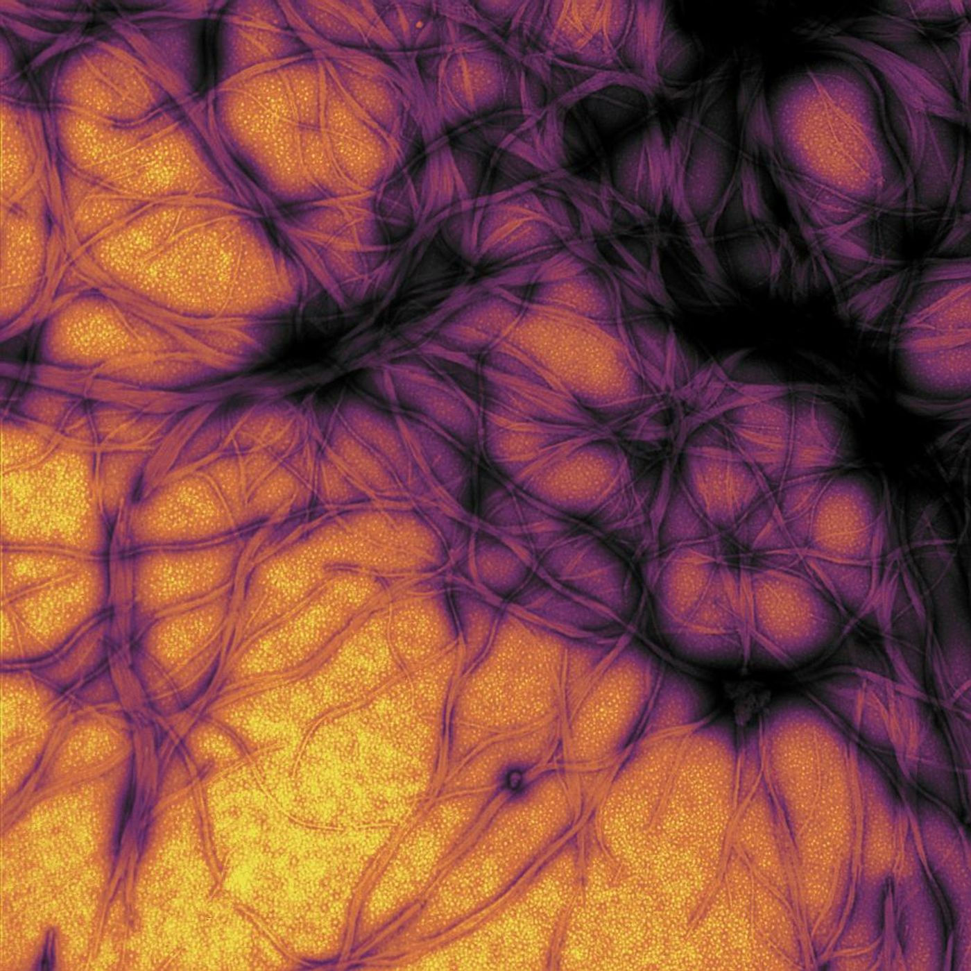 Prion protein expressed in E. coli, purified and fibrillized at pH 7. Recombinant proteins such as the prion protein shown here are often used to model how proteins misfold and sometimes polymerize in neurodegenerative disorders. / Credit: NIAID