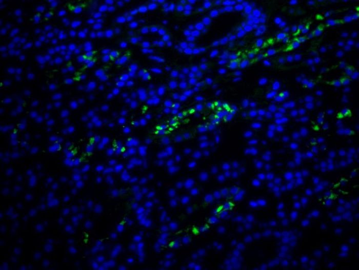 FISH images from kidney biopsy of the DRESS patient showing HHV-6 encoded sncRNA-U14 (green). DNA is counter stained with DAPI (blue). / Credit: Team Prusty