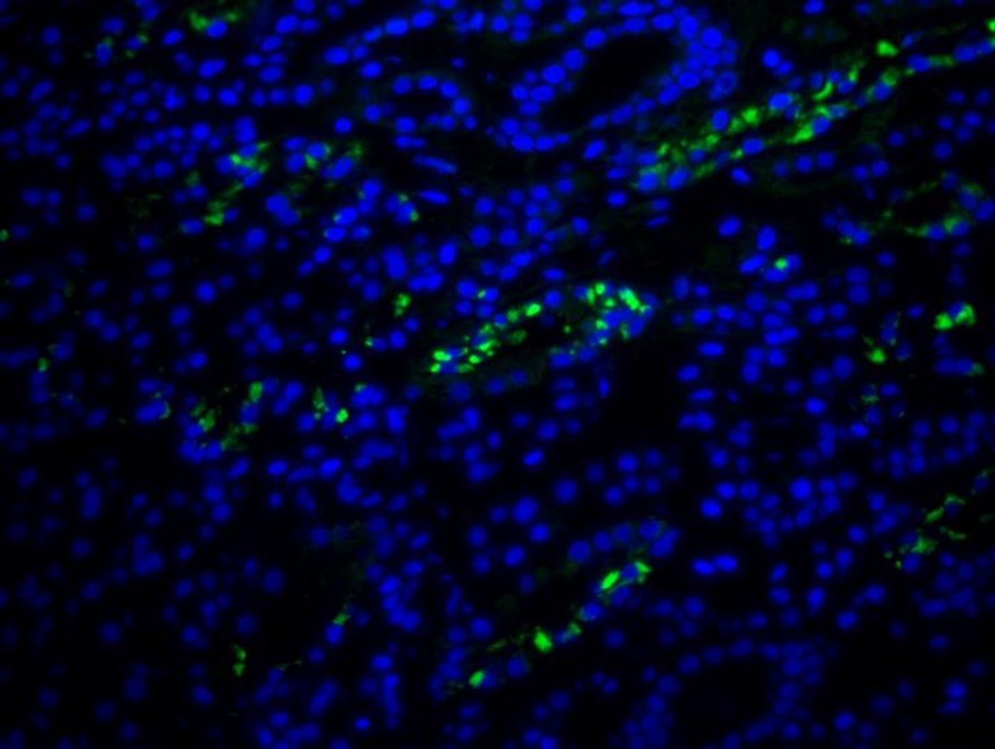 FISH images from kidney biopsy of the DRESS patient showing HHV-6 encoded sncRNA-U14 (green). DNA is counter stained with DAPI (blue). / Credit: Team Prusty