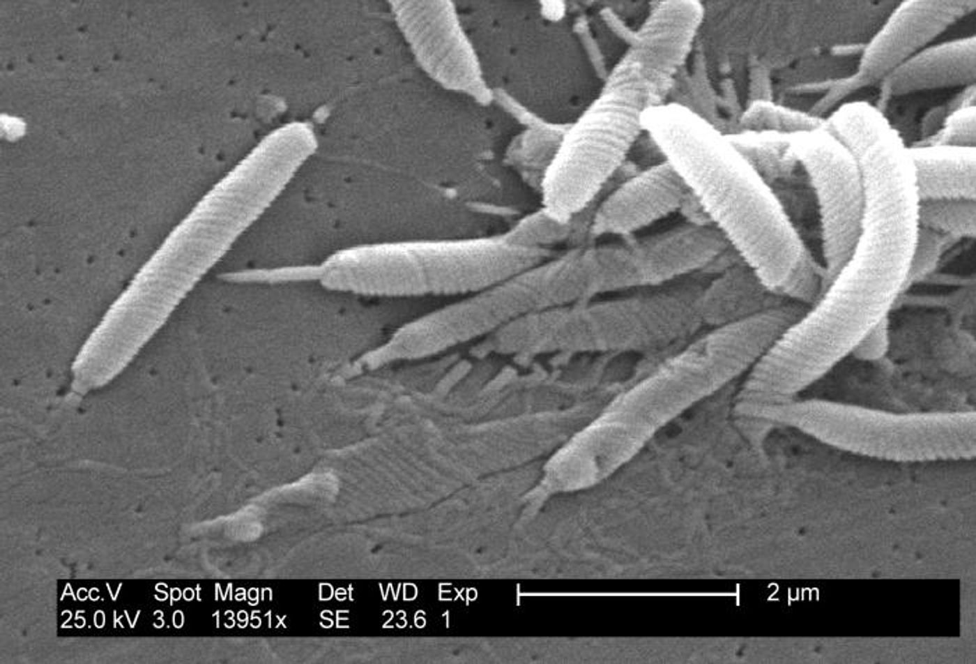 A bacterium that is closely related to Helicobacter / Credit: CDC/Dr. Patricia Fields, Dr. Collette Fitzgerald