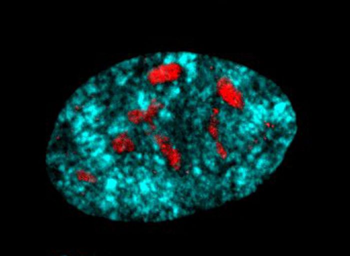 In the absence of SIRT7, a human primary cell displays multiple nucleoli. DNA was stained with DAPI (turquoise) and nucleolus was stained with anti-fibrillarin (red). / Credit: Silvana Paredes