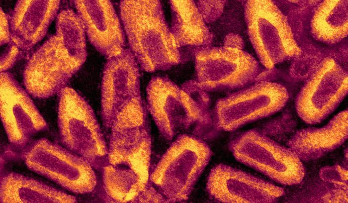 Electron micrograph of rabies viruses
