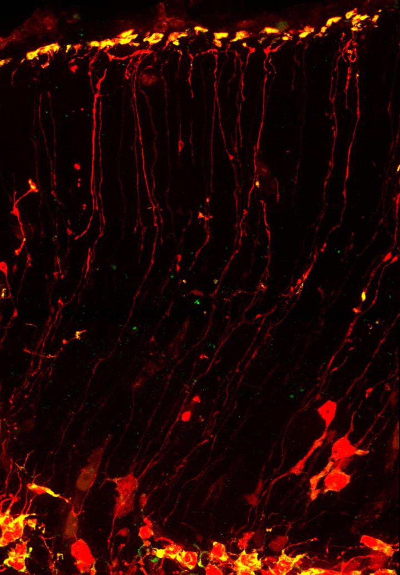 RNA (yellow) moves quickly toward the uppermost layer of the brain along the path of neural stem cells (red). Duke researchers visualized this phenomenon in living cells, and found that a protein implicated in Fragile X syndrome is important to this RNA transit system. / Credit: Louis-Jan Pilaz, Duke University