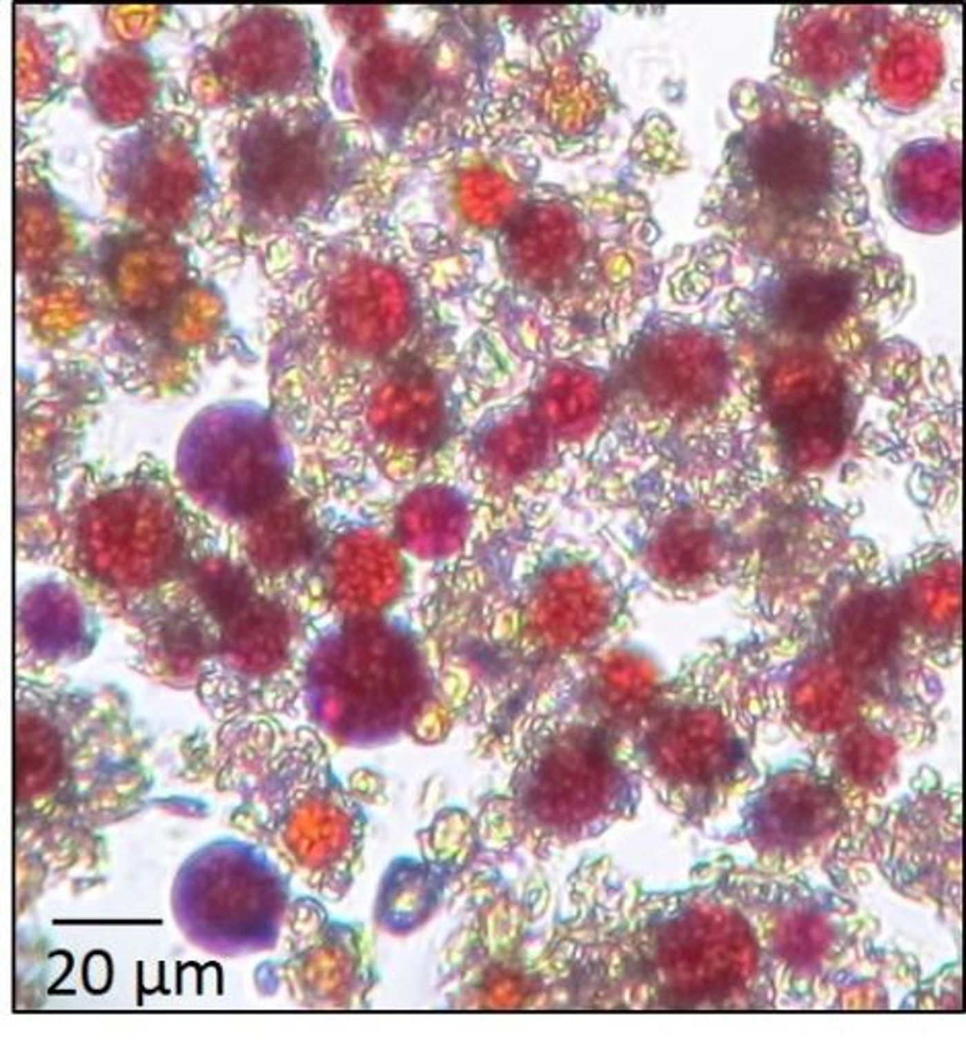 A colony of red snow algae under a microscope. Image by Stefanie Lutz/GFZ