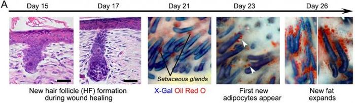 The progression of the wound during healing when hair follicles are present. / Credit: Penn Medicine
