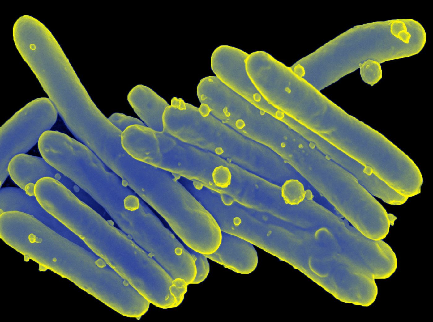 Mycobacterium leprae causes leprosy