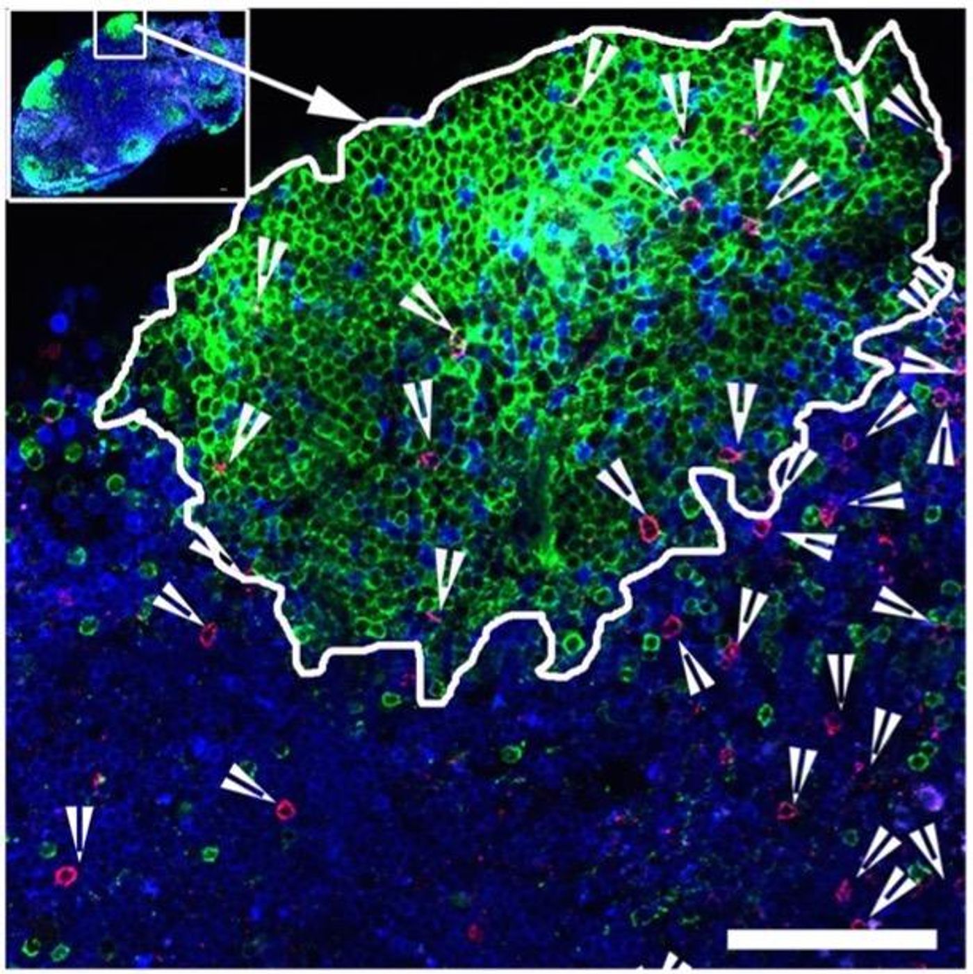 The green areas are B cell follicles within germinal centers, specialized areas of lymph nodes where HIV-infected cells hide out. Red spots indicate antiviral T cells. Credit: Rama Rao Amara, Emory Vaccine Center