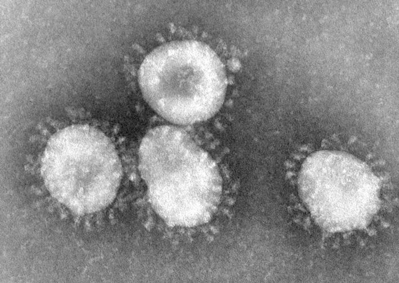 Coronaviruses are a group of viruses known for causing the common cold.