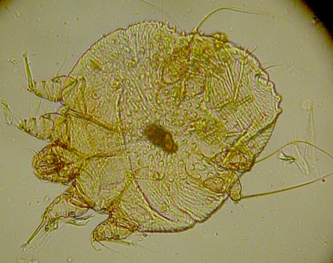 Photomicrograph of itch mite Sarcoptes scabiei from Wikimedia/Kalumet