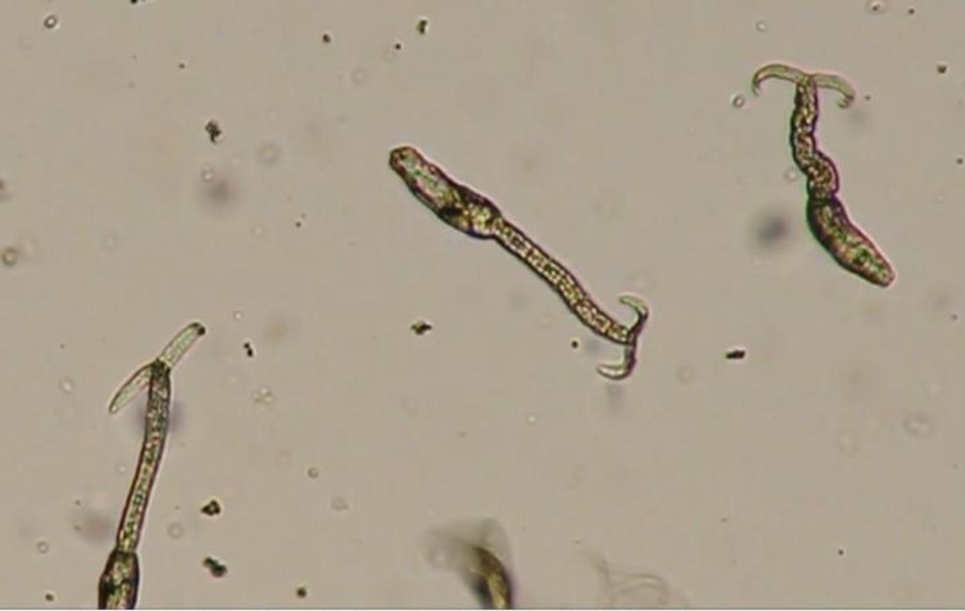 Researchers found that heat shock protein 70 induces Schistosoma larvae to hone in on and penetrate skin, indicating the protein is a regulator of the molecular pathway for invasion. / Credit: Emmitt Jolly