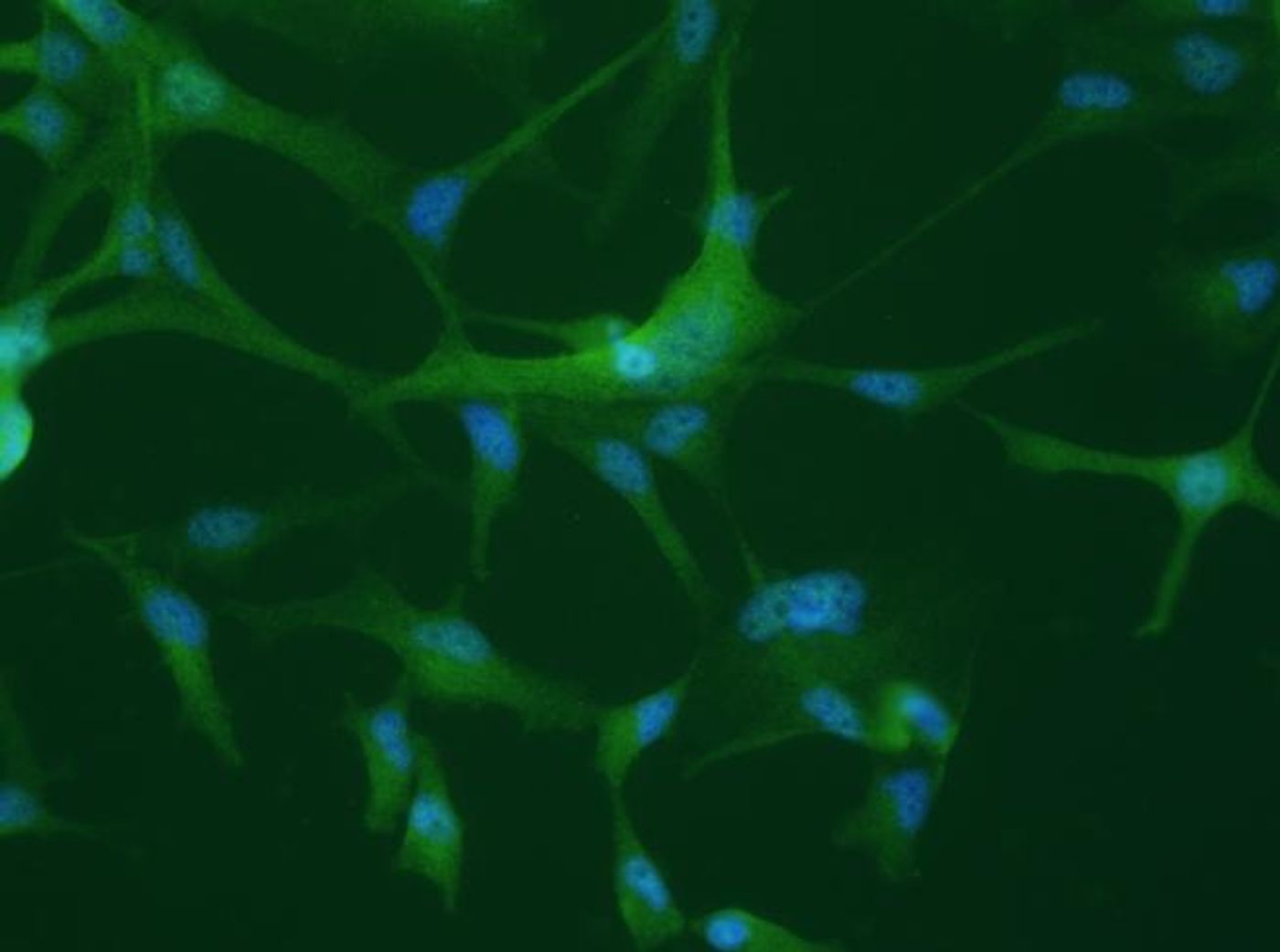 Confocal microscope image of cultured human oligodendrocytes. The differential expression of hnRNPs may lead to dysfunction of oligodendrocytes, glial cells that produce myelin and are important for neuronal activity. / Credit: Daniel Martins-de-Souza, University of Campinas