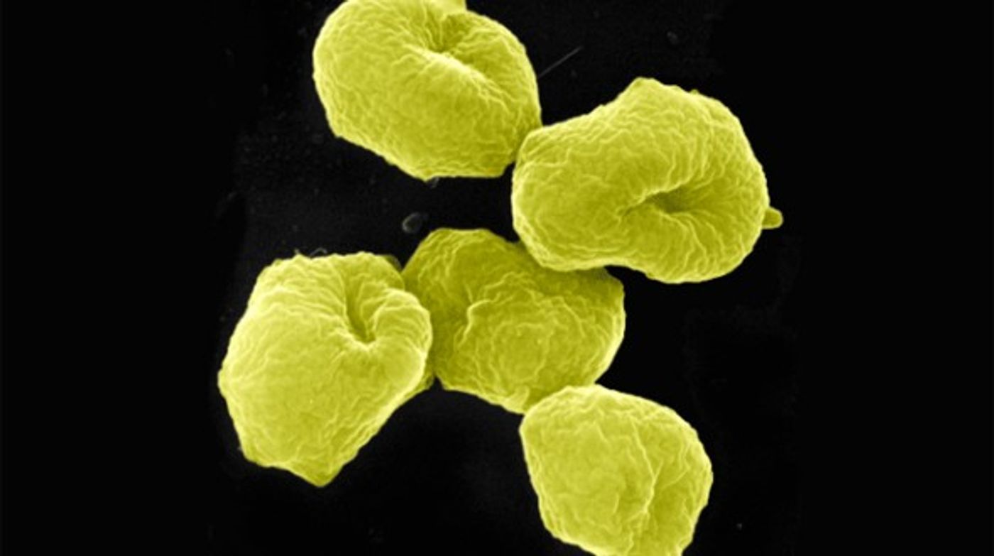 Archaea come in unique shapes.