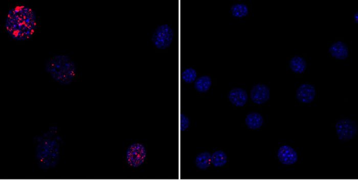 (Left) Progeria mouse fibroblast cells; (Right) Progeria mouse fibroblast cells rejuvinated by partial reprogramming. /Credit: Courtesy of Juan Carlos Izpisua Belmonte Lab /Salk Institute