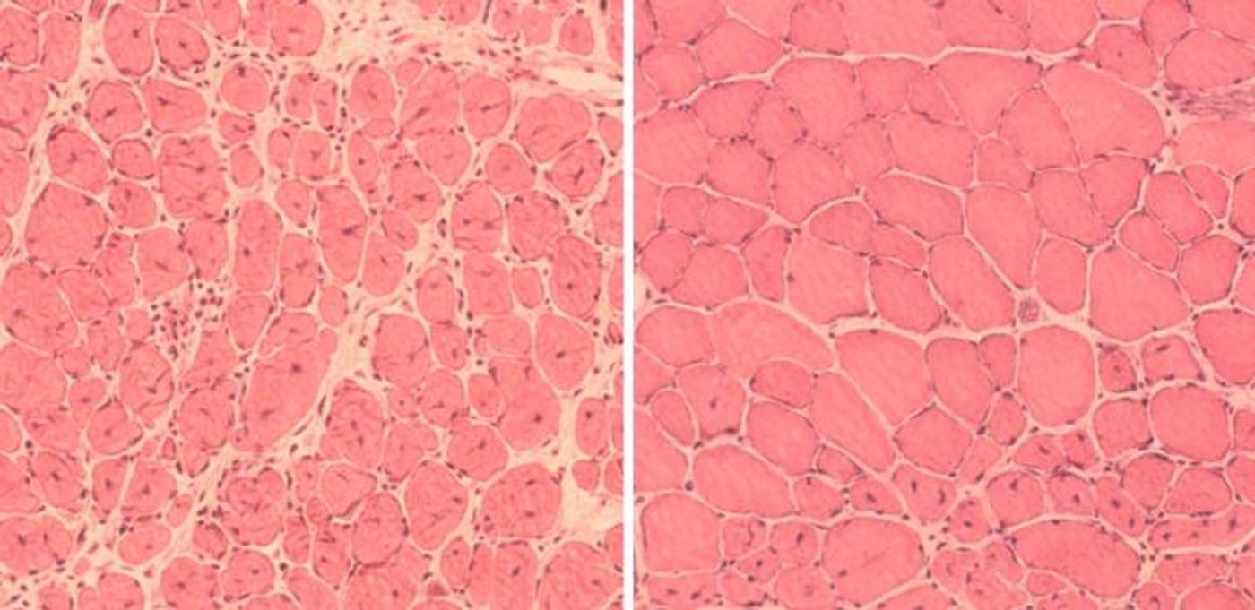 (Left) Impaired muscle repair in aged mice; (Right) Improved muscle regeneration in aged mice subjected to reprogramming. / Credit: Courtesy of Juan Carlos Izpisua Belmonte Lab /Salk Institute