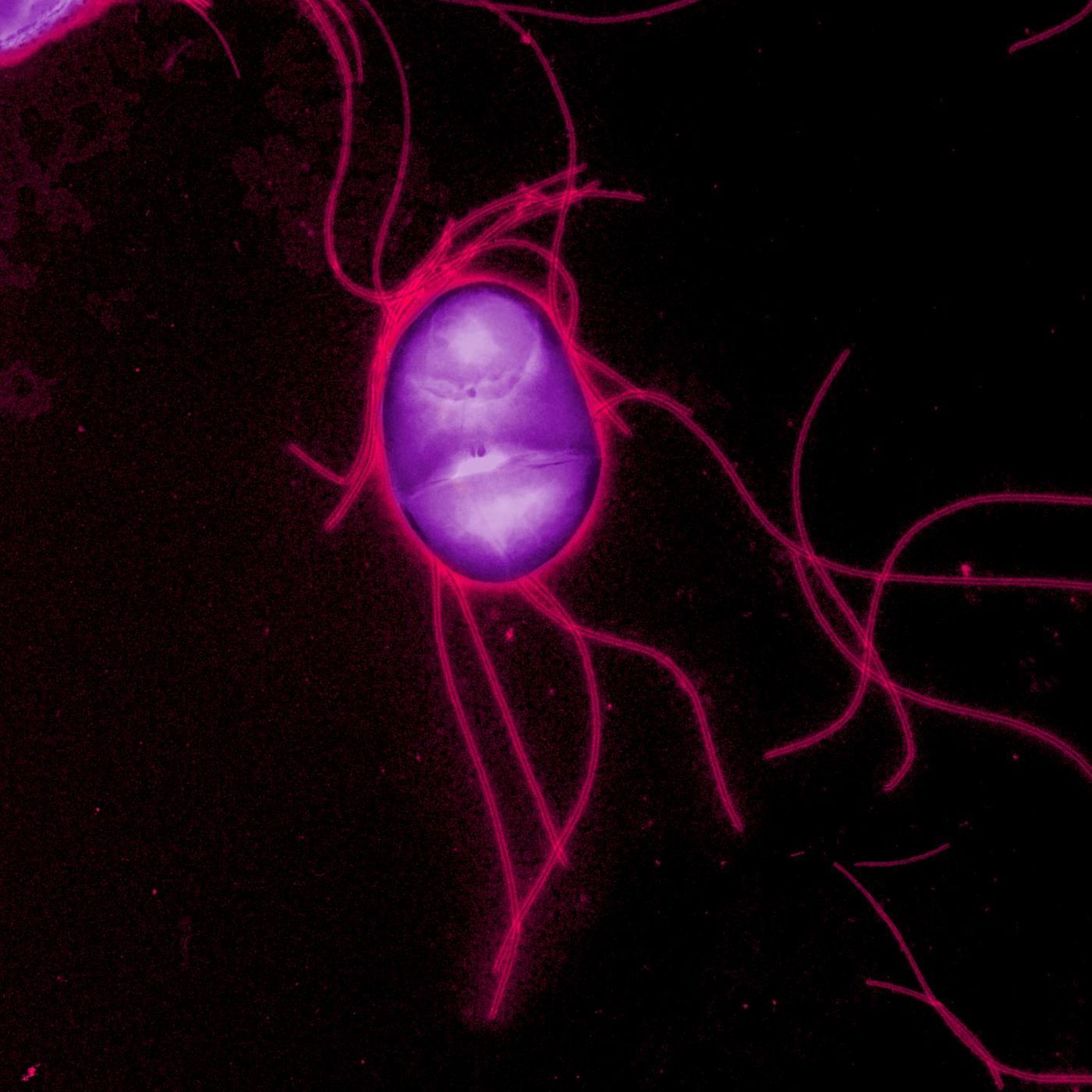 A Salk Institute study shows how Salmonella Typhimurium blocks the appetite loss response in hosts to both make the host healthier and promote the bacteria's survival and transmission. / Credit: Salk Institute