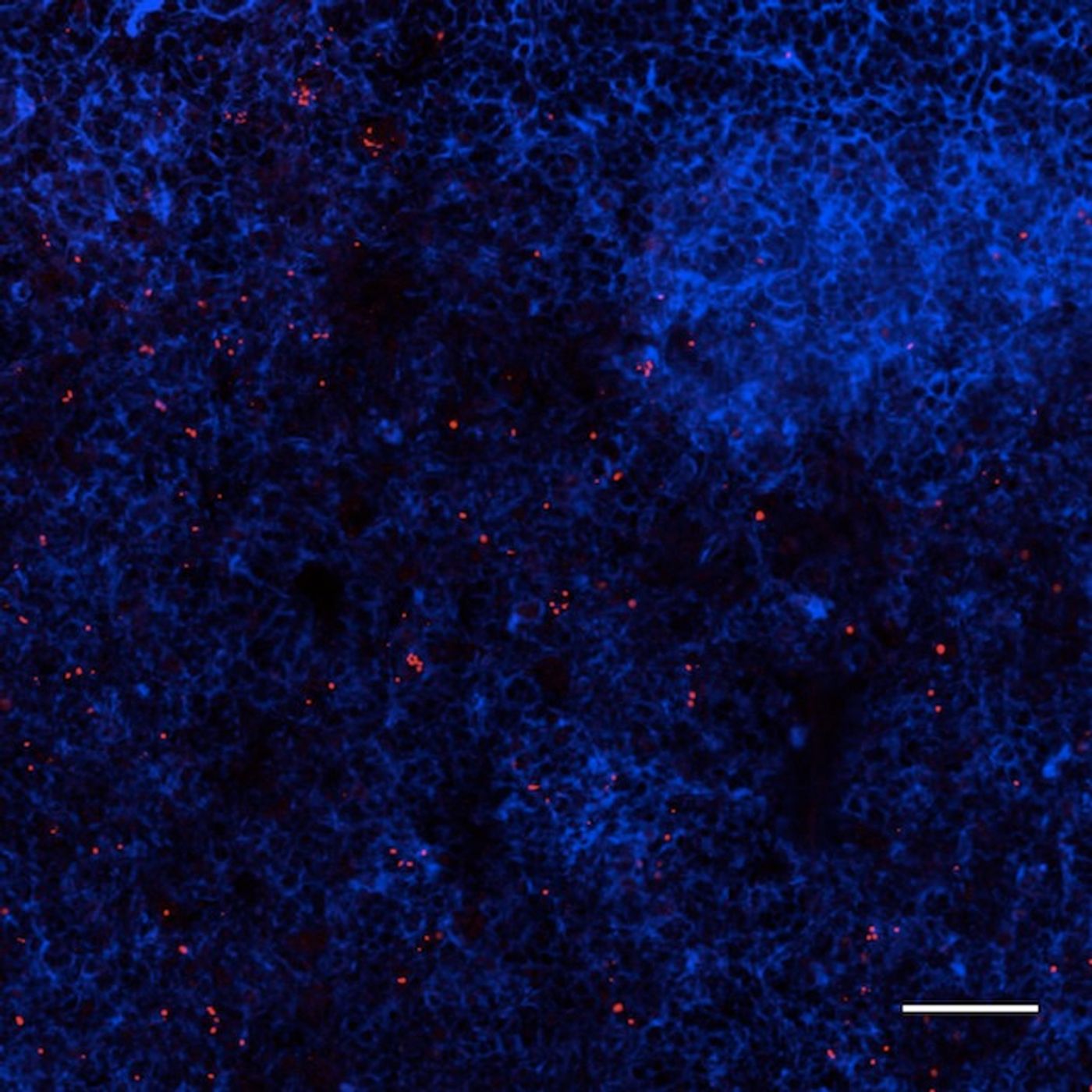 This image shows lymph nodes infected with ST313 Salmonella. / Credit: Carden et al./Cell Host & Microbe 2017