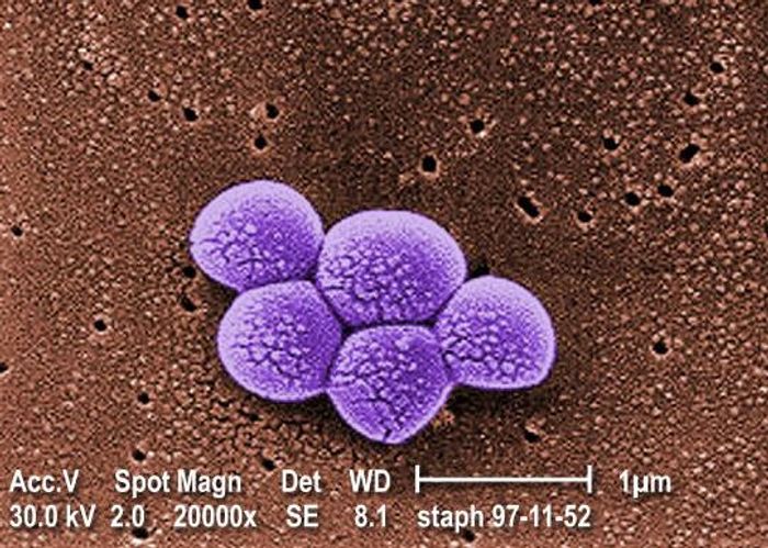 scanning electron micrograph (SEM) depicts a grouping of methicillin resistant Staphylococcus aureus (MRSA) bacteria.  / Credit: CDC