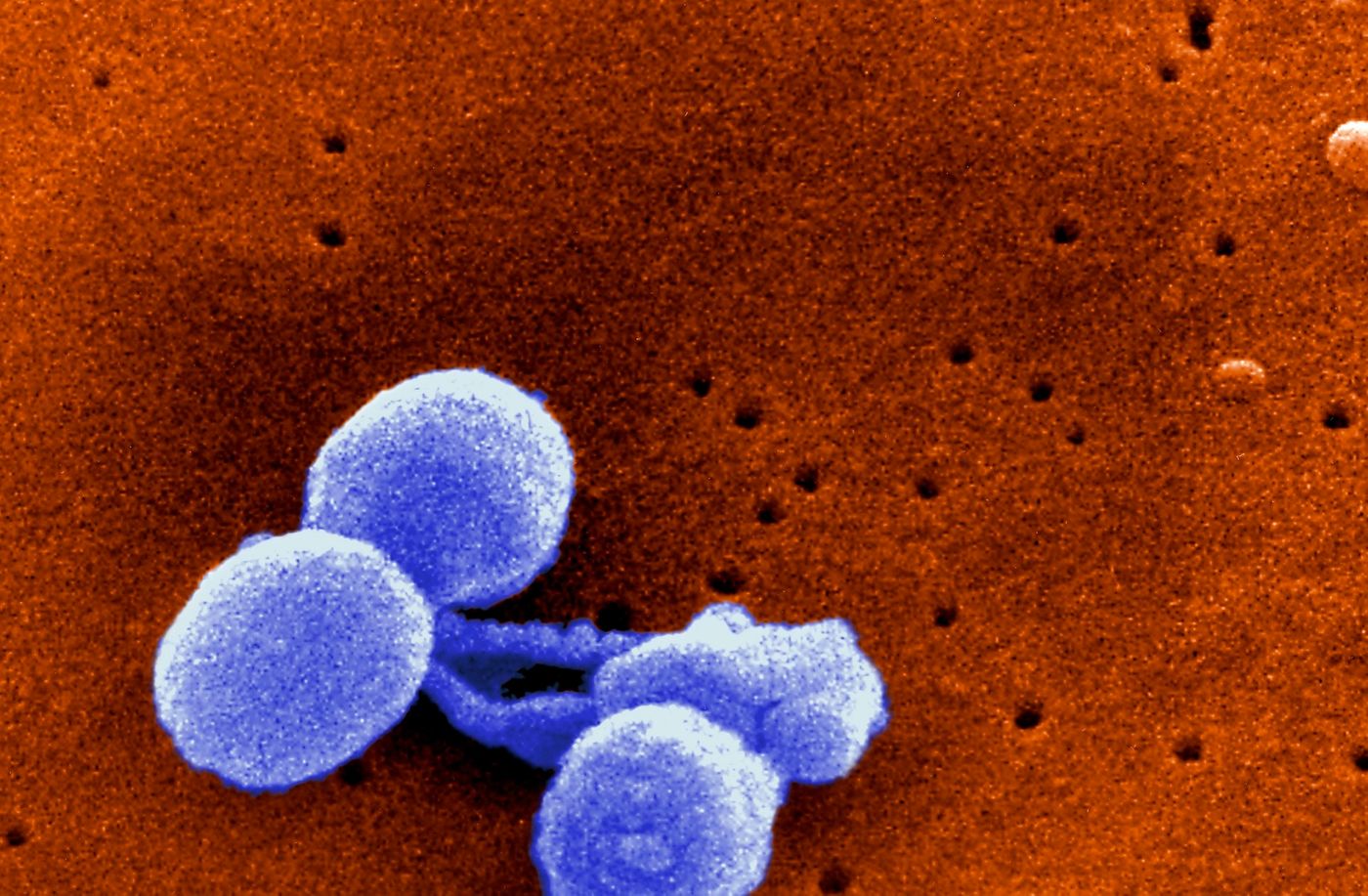 Scanning electron micrograph of Streptococcus pneumoniae