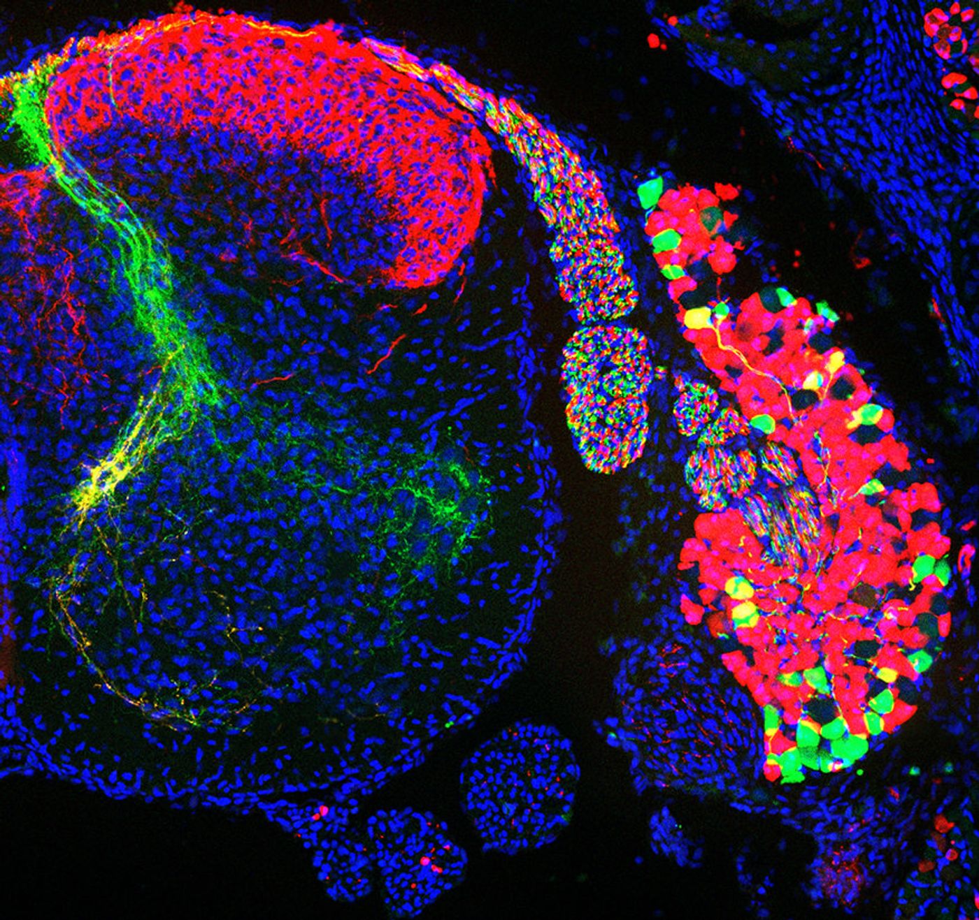 The cell bodies of sensory neurons that detect proprioceptive information (green) and that detect thermal and tactile information (red) in a dorsal root ganglion (right) and their axons in the spinal cord (left) / Image credit: Stephan Dietrich, Zampieri Lab, Max Delbrück Center