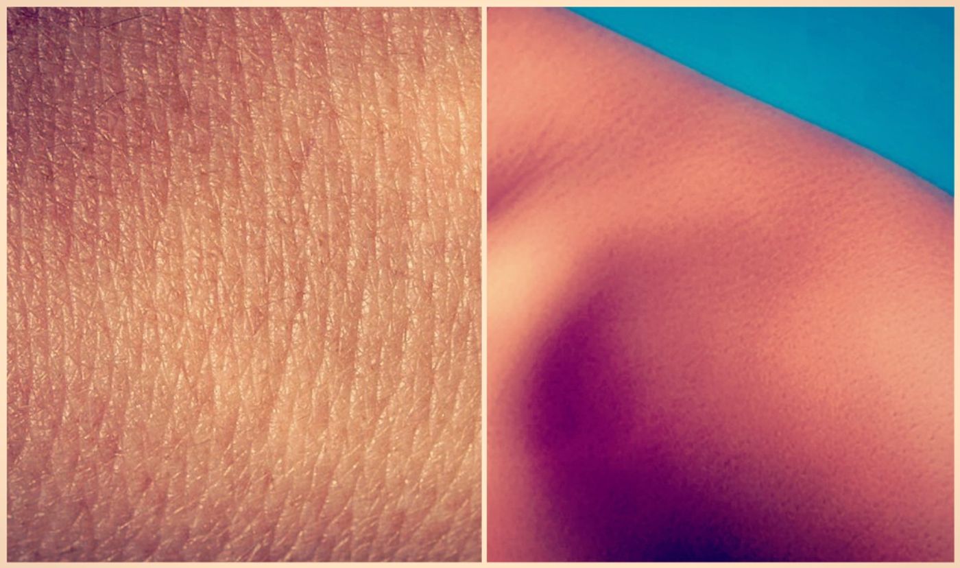 Image: skin, credit: public domain 