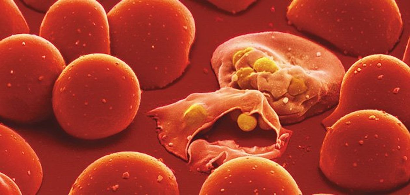 Malaria parasites infect and lyse red blood cells.
