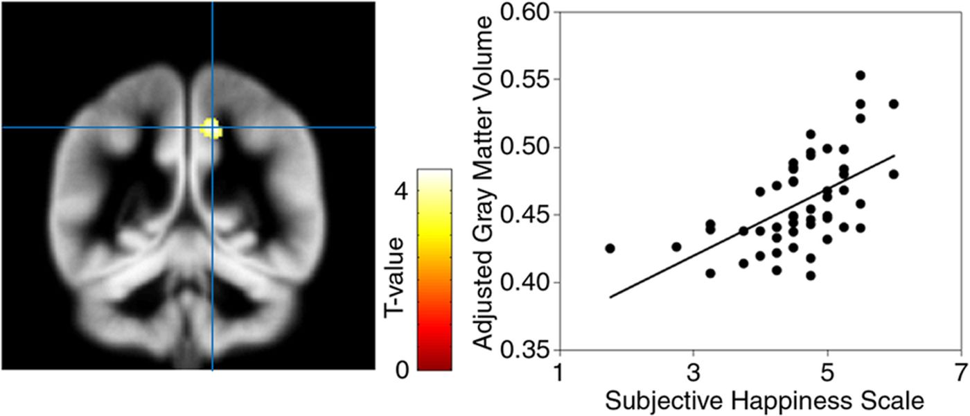 Brain region significantly associated with the subjective happiness score