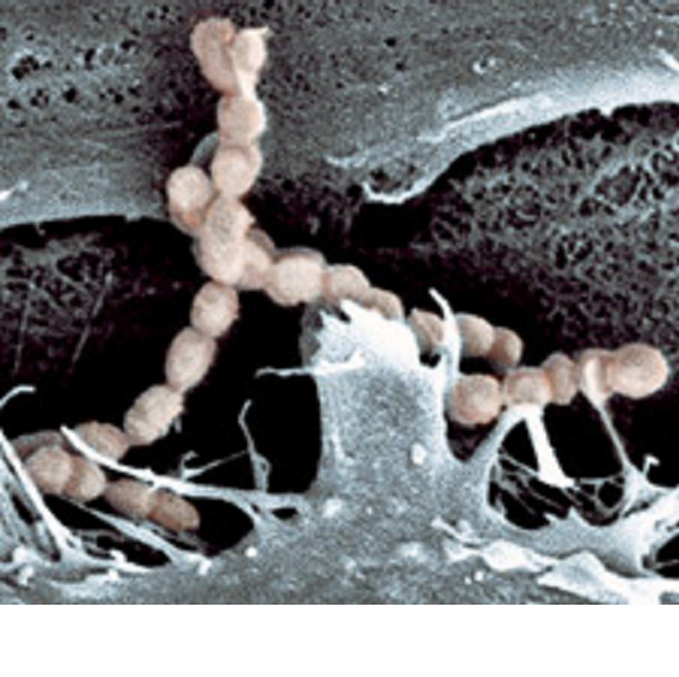 Streptococcus suis is a swine pathogen as well as an emerging pathogen in humans that causes toxic-shock syndrome. 