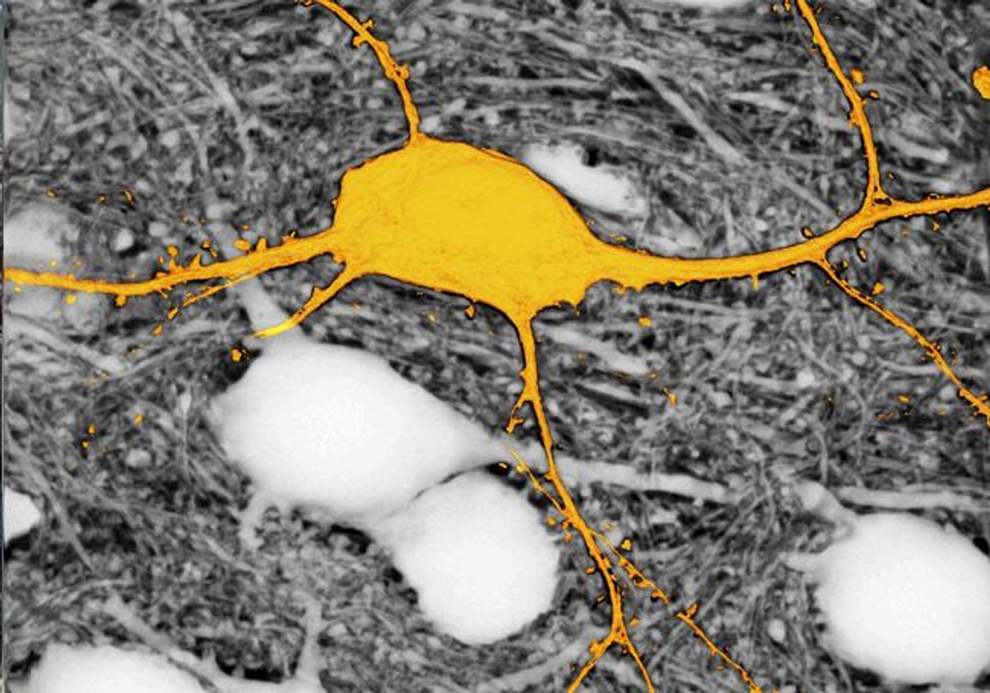 Image of the neuron labelled in yellow surrounded by unlabelled neurons (appearing in white) using the SUSHI technique. Without this technique, the neurons appearing in white would not be visible. / Credit: © Jan Tønnesen & Valentin Nägerl.