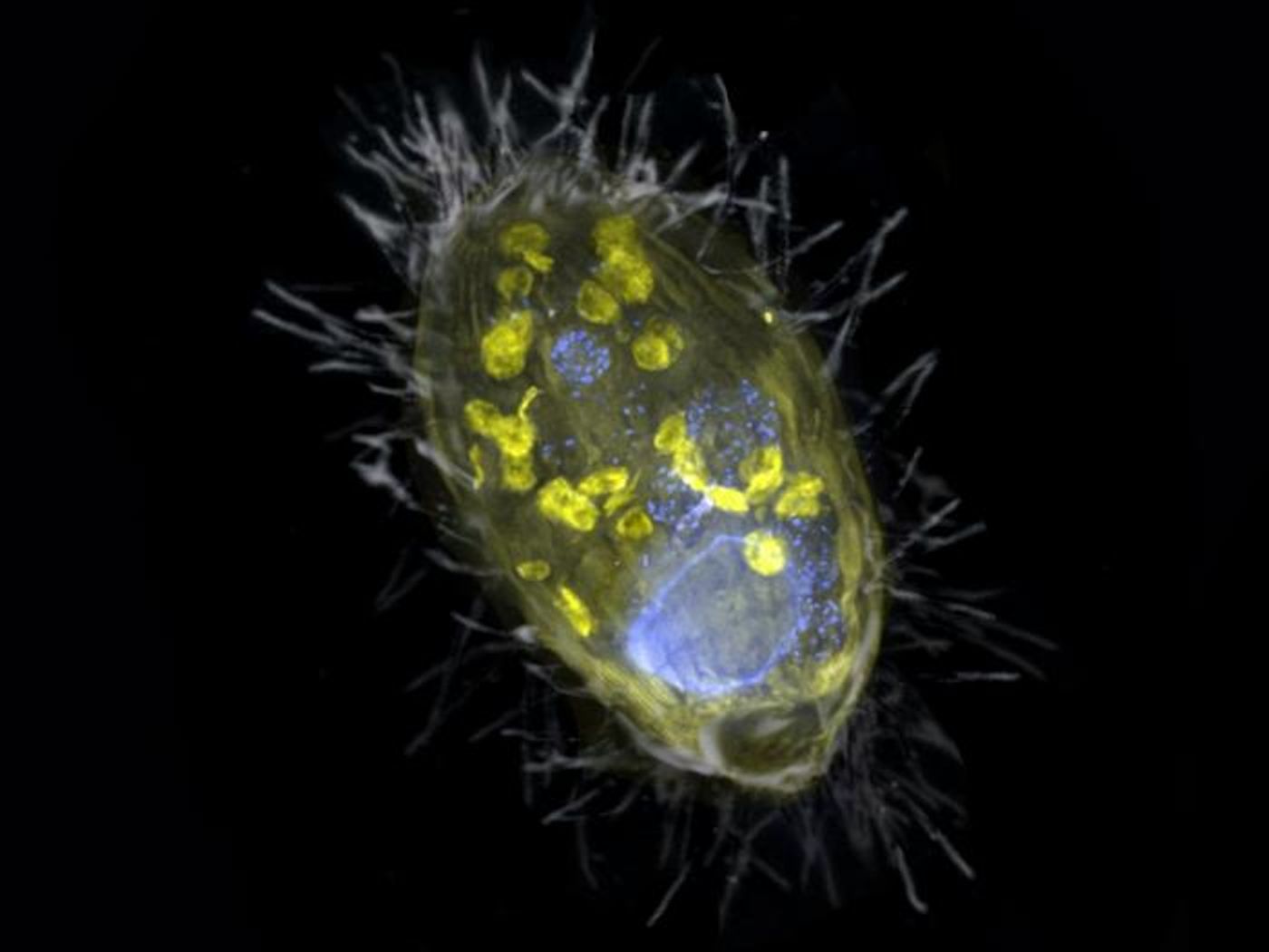 The endosymbiont 'Candidatus Azoamicus ciliaticola' and its ciliate host illustrated as a composite of SEM, grey and fluorescence images. Visible is the endosymbiont (yellow) and bacterial prey in food vacuoles as well as the cell nucleus (blue).  Credit: Image © S. Ahmerkamp/Max Planck Institute for Marine Microbiology