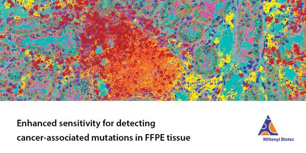A Novel Method for the Isolation of Highly Pure Carcinoma Cell Populations from FFPE Tissue Improves Sensitivity for Detecting Somatic Mutations