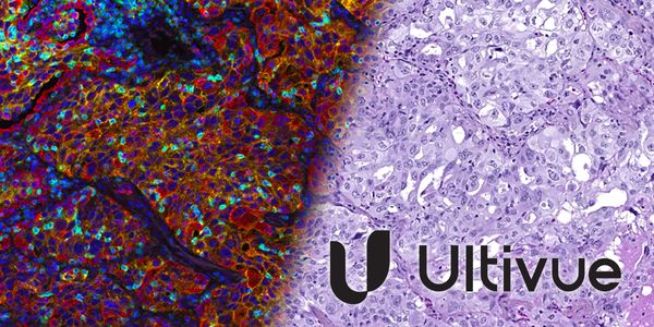 Understanding immune activation and evasion in the tumor microenvironment: Why lymphocyte relationships matter